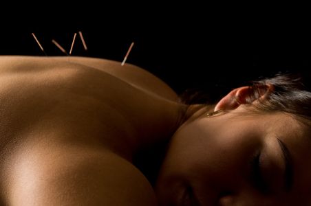 Acupuncture Treatment is very relaxing